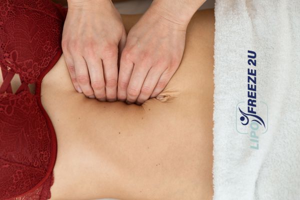 diastasis recti treatment Cumbernauld
