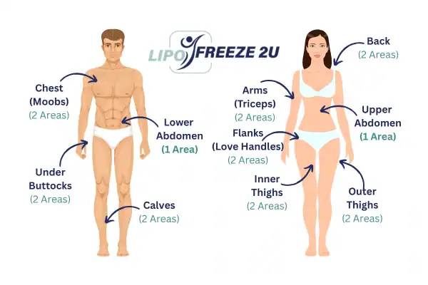 Areas you can have fat freezing treatment Cumbernauld