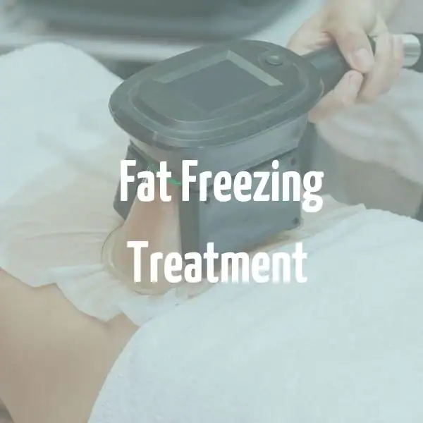 fat freezing treatment Cumbernauld