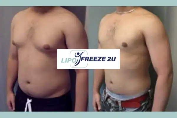 How Long Does It Take to See Results Cumbernauld?