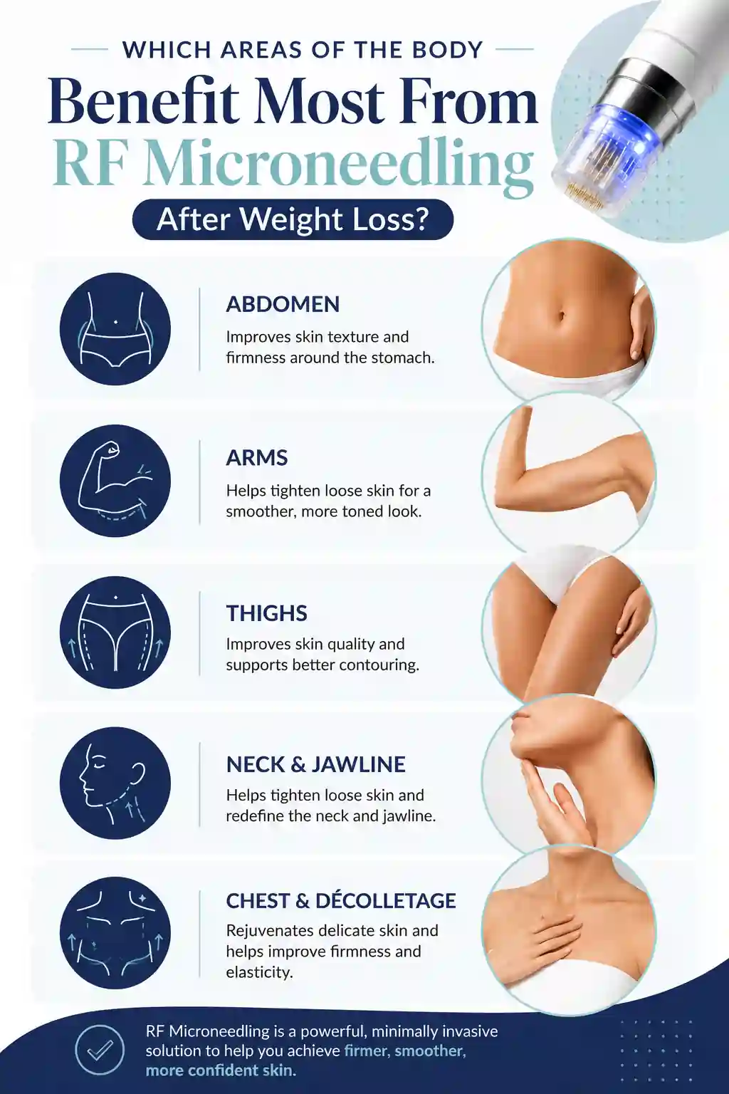Which Areas of the Body Benefit Most From RF Microneedling After Weight Loss Cumbernauld